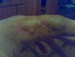 Заживает потихоньку)