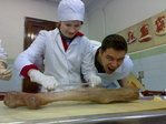 Ампутированная гангренная нога...
