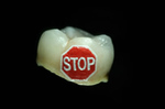 stop
