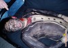 Он помому концы отдал вообще