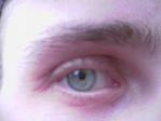 Zalechi's eye