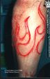 Scar_01_026