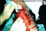 Scar_01_022