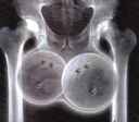 xraybowling