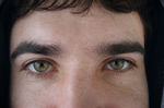 getImage (4)