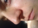 getImageCAST2UYL